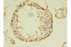 Immunohistochemistry of paraffin-embedded human testis tissue using ABIN7144183 at dilution of 1:100 (ASB13 antibody  (AA 1-173))