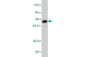 Western Blot detection against Immunogen (53. (Elastase 3A antibody  (AA 16-270))