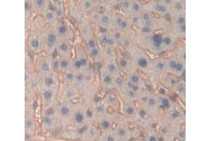 Used in DAB staining on fromalin fixed paraffin- embedded Kidney tissue