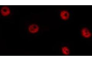 ABIN6277434 staining HepG2 by IF/ICC. (TCF7 antibody)