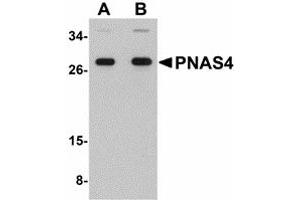 Image no. 1 for anti-PPPDE Peptidase Domain Containing 1 (PPPDE1) (C-Term) antibody (ABIN478034) (PPPDE1 antibody  (C-Term))