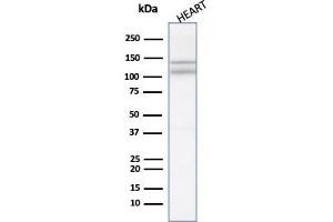 Western blot analysis of Heart tissue lysate using N-Cadherin Mouse Monoclonal Antibody (8C11). (N-Cadherin antibody  (Extracellular Domain))