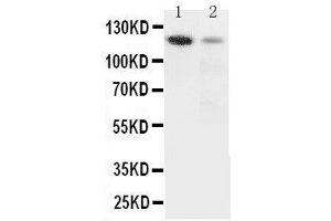 Anti-Integrin alpha 3 antibody, Western blotting Lane 1: Rat Heart Tissue Lysate Lane 2: HELA Cell Lysate (ITGA3 antibody  (N-Term))