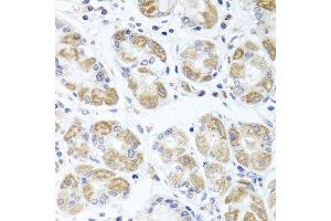 Immunohistochemistry of paraffin-embedded human stomach using ACP1 antibody. (ACP1 antibody  (AA 15-144))