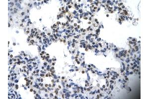 Rabbit Anti-ILF2 Antibody       Paraffin Embedded Tissue:  Human cardiac cell   Cellular Data:  Epithelial cells of renal tubule  Antibody Concentration:   4.