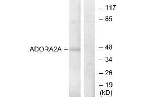 Immunohistochemistry analysis of paraffin-embedded human brain tissue using ADORA2A antibody.