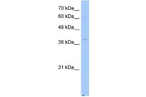 NSDHL antibody used at 2. (NSDHL antibody)
