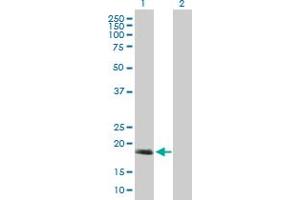 Western Blot analysis of C17orf49 expression in transfected 293T cell line by C17orf49 MaxPab polyclonal antibody. (C17orf49 antibody  (AA 1-172))