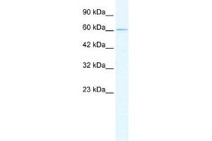 WB Suggested Anti-GABRD Antibody Titration:  0. (GABRD antibody  (N-Term))