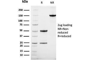 SDS-PAGE Analysis Purified HER-2 Mouse Monoclonal Antibody (HRB2/258). (ErbB2/Her2 antibody  (Extracellular Domain))