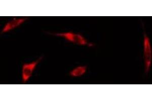 Immunofluorescence (fixed cells) (IF/ICC) image for anti-erythrocyte Membrane Protein Band 4.9 (Dematin) (EPB49) (pSer403) antibody (ABIN6255309)