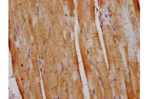 IHC image of ABIN7150742 diluted at 1:400 and staining in paraffin-embedded human skeletal muscle tissue performed on a Leica BondTM system.