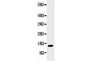 Anti-Estrogen Inducible Protein pS2 antibody, Western blottingWB: Rat Stomach Tissue Lysate (TFF1 antibody  (Middle Region))