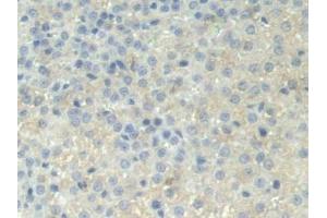IHC-P analysis of Rat Adrenal gland Tissue, with DAB staining.