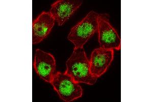 Fluorescent image of A549 cell stained with CDKN1C Antibody (N-term) (ABIN654899 and ABIN2844548). (CDKN1C antibody  (N-Term))