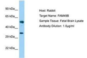 Image no. 1 for anti-Family with Sequence Similarity 49, Member B (FAM49B) (AA 22-71) antibody (ABIN6750181) (FAM49B antibody  (AA 22-71))