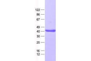 Validation with Western Blot (ZC3H8 Protein (His tag))