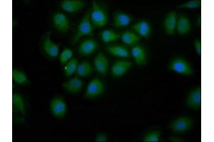 Immunofluorescence staining of A549 cells with ABIN7155179 at 1:200, counter-stained with DAPI. (PDE9A antibody  (AA 426-533))