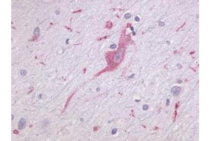 Anti-LPHN1 antibody IHC of human brain, neurons and glia. (Latrophilin 1 antibody  (N-Term))