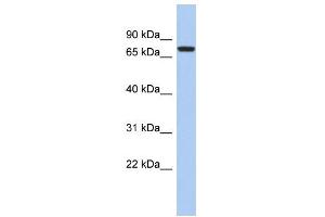 WB Suggested Anti-SNRK Antibody Titration: 0. (SNRK antibody  (Middle Region))