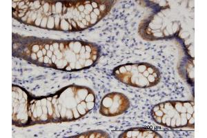 Immunoperoxidase of monoclonal antibody to ARFIP1 on formalin-fixed paraffin-embedded human colon. (ARFIP1 antibody  (AA 1-101))
