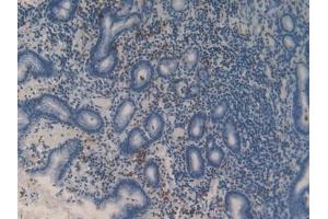 Detection of MMP9 in Human Stomach Tissue using Polyclonal Antibody to Matrix Metalloproteinase 9 (MMP9) (MMP 9 antibody  (AA 213-399))