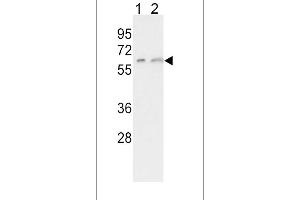 Western blot analysis of CYP7A1 Antibody in K562(lane 1), HepG2(lane 2) cell line lysates (35ug/lane) (CYP7A1 antibody  (C-Term))