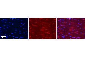 Rabbit Anti-CSK Antibody Catalog Number: ARP52042_P050 Formalin Fixed Paraffin Embedded Tissue: Human Heart Tissue Observed Staining: Cytoplasm in endothelial cells in capillaries Primary Antibody Concentration: 1:100 Other Working Concentrations: N/A Secondary Antibody: Donkey anti-Rabbit-Cy3 Secondary Antibody Concentration: 1:200 Magnification: 20X Exposure Time: 0. (CSK antibody  (Middle Region))