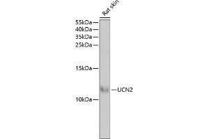 Western blot analysis of extracts of rat skin, using UCN2 antibody (ABIN6129579, ABIN6149881, ABIN6149882 and ABIN6222147) at 1:1000 dilution. (Urocortin 2 antibody  (AA 20-112))