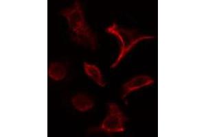 ABIN6266830 staining HeLa cells by IF/ICC. (COL4A1 antibody)