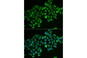 Immunofluorescence analysis of MCF-7 cells using RHOD antibody (ABIN5973862). (RHOD antibody)
