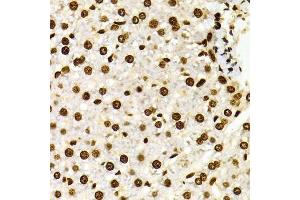 Immunohistochemistry of paraffin-embedded Rat liver using DiMethyl-Histone H3-K27 antibody. (Histone 3 antibody  (H3K27me))