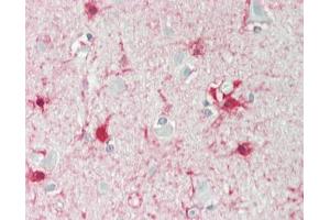 Human Brain, Cortex: Formalin-Fixed, Paraffin-Embedded (FFPE) (ALDH1L1 antibody)