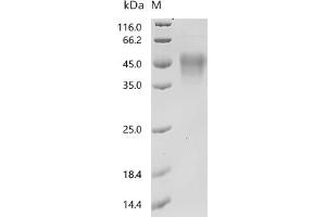 (Tris-Glycine gel) Discontinuous SDS-PAGE (reduced) with 5 % enrichment gel and 15 % separation gel.