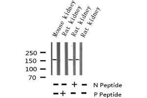 Western blot analysis of Phospho-VEGFR2 (Tyr1214) expression in various lysates (VEGFR2/CD309 antibody  (pTyr1214))