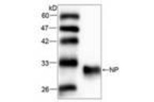Image no. 1 for anti-Purine Nucleoside Phosphorylase (PNP) (AA 68-289) antibody (ABIN791487) (PNP antibody  (AA 68-289))