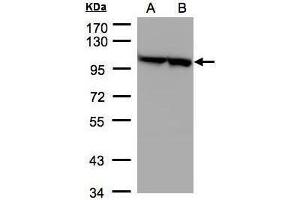 WB Image Sample(30 μg of whole cell lysate) A:293T B:A431, 7. (EEF2 antibody)