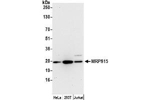 anti-Mitochondrial Ribosomal Protein S15 (MRPS15) (AA 207-257) antibody