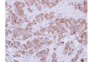 Immunohistochemistry (IHC) image for anti-HIV-1 Tat Interactive Protein 2, 30kDa (HTATIP2) antibody (ABIN2857073)