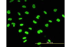 Immunofluorescence of monoclonal antibody to CBX3 on HeLa cell. (CBX3 antibody  (AA 1-183))