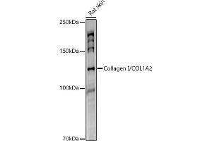 Western blot analysis of extracts of Rat skin, using Collagen I/COL1 antibody (1059) at 1:1000 dilution. (COL1A2 antibody)