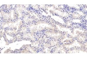 Detection of ANXA3 in Human Kidney Tissue using Monoclonal Antibody to Annexin A3 (ANXA3) (Annexin A3 antibody  (AA 2-323))