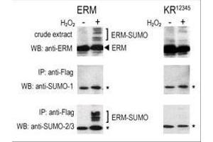 COS-7 cells were transfected for 24 hrs with a plasmid expressing FLAG-ERM (left panels) or FLAG-ERM K (right panels). (SUMO1 antibody  (C-Term))