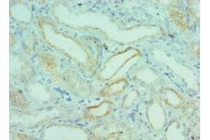 Immunohistochemistry of paraffin-embedded human kidney tissue using ABIN7145824 at dilution of 1:100 (BRD9 antibody  (AA 338-597))