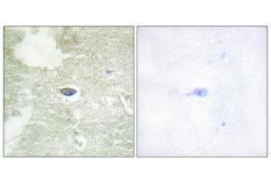 Immunohistochemistry (IHC) image for anti-Transforming Growth Factor, beta Receptor II (70/80kDa) (TGFBR2) (pSer225), (pSer250) antibody (ABIN1847405) (TGFBR2 antibody  (pSer225, pSer250))