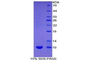 SDS-PAGE (SDS) image for Urocortin 2 (UCN2) (AA 31-112) protein (His tag) (ABIN1877924) (Urocortin 2 Protein (UCN2) (AA 31-112) (His tag))