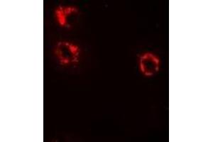 Immunofluorescent analysis of Anamorsin staining in HepG2 cells. (CIAPIN1 antibody)