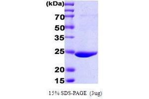 Figure annotation denotes ug of protein loaded and % gel used. (GST Protein (AA 1-224))