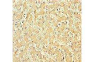 Immunohistochemistry of paraffin-embedded human liver tissue using ABIN7148261 at dilution of 1:100 (Collagen, Type VI, alpha 6 (COL6A6) (AA 430-982) antibody)