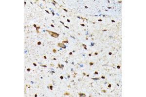 Immunohistochemistry of paraffin-embedded mouse spinal cord using CAMKIV Rabbit mAb (ABIN7266021) at dilution of 1:100 (40x lens). (CAMK4 antibody)